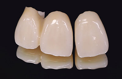 歯科技工士との連携を密にとっています